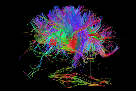 What Nootropics Are and How They Can Help You Be Your Most Present, Capable Self